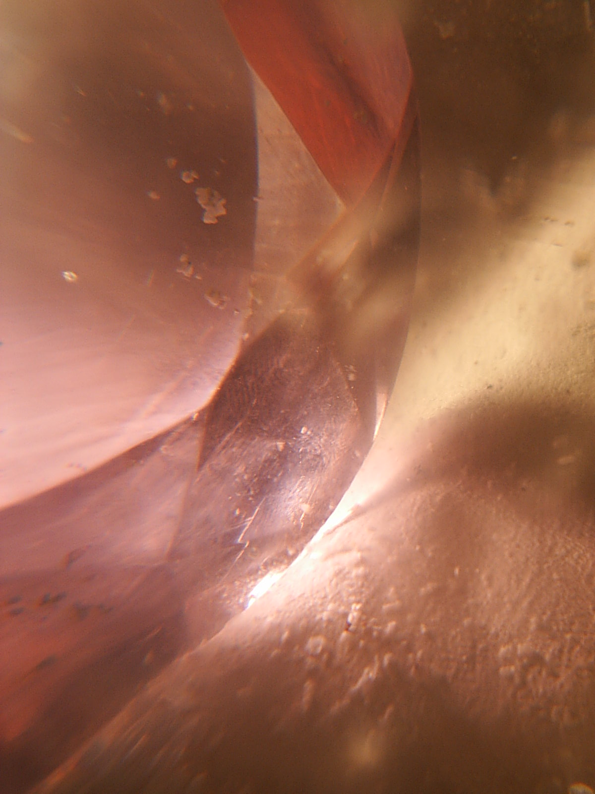 Filtro vibracional Fildalas